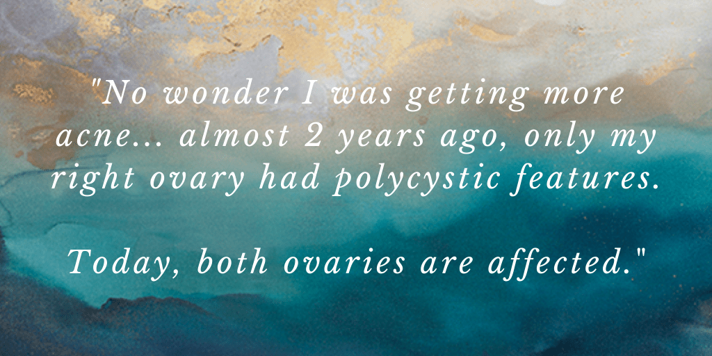 "No wonder I was getting more acne... almost 2 years ago, only my right ovary had polycystic features.
 
Today, both ovaries are affected."